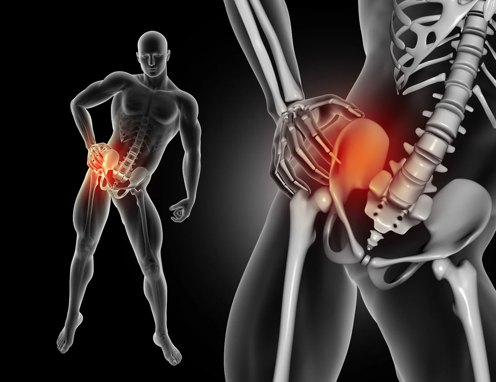 Sciatica and Disc Herniation: Connecting the Painful Dots