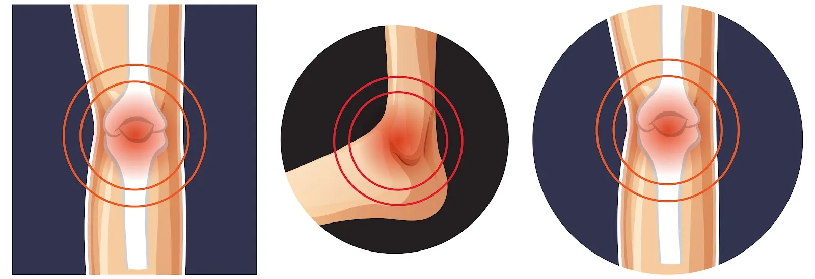 Walking Tall: The Role of Chiropractic Care in Alleviating Leg Pain