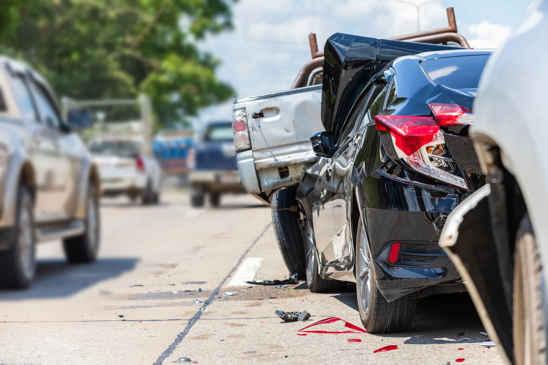 Why You Should See a Chiropractor After an Auto Accident