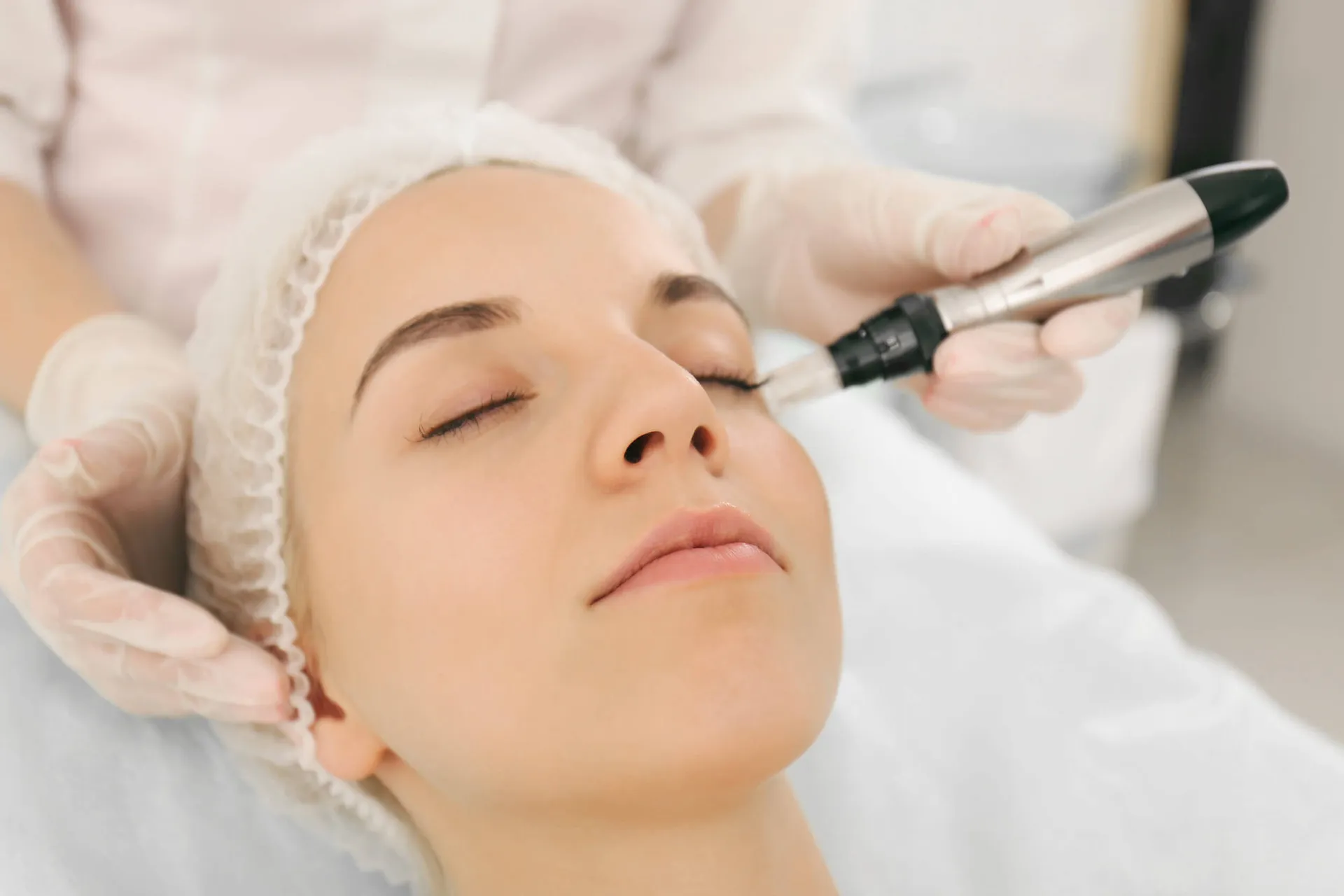 Woman with eyes closed as a gloved technician uses a microneedling pen on her cheek.