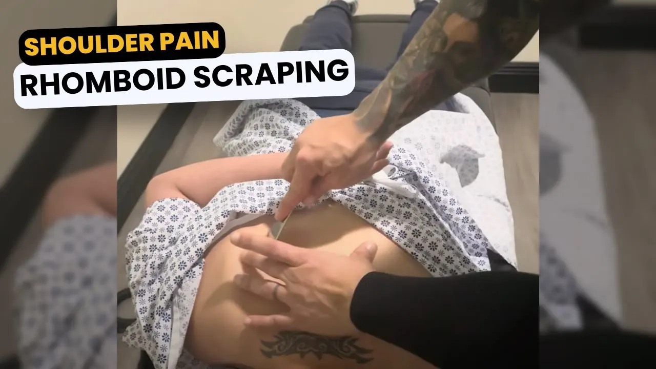 Pain Relief for Under Shoulder Blade – Rhomboid Scraping