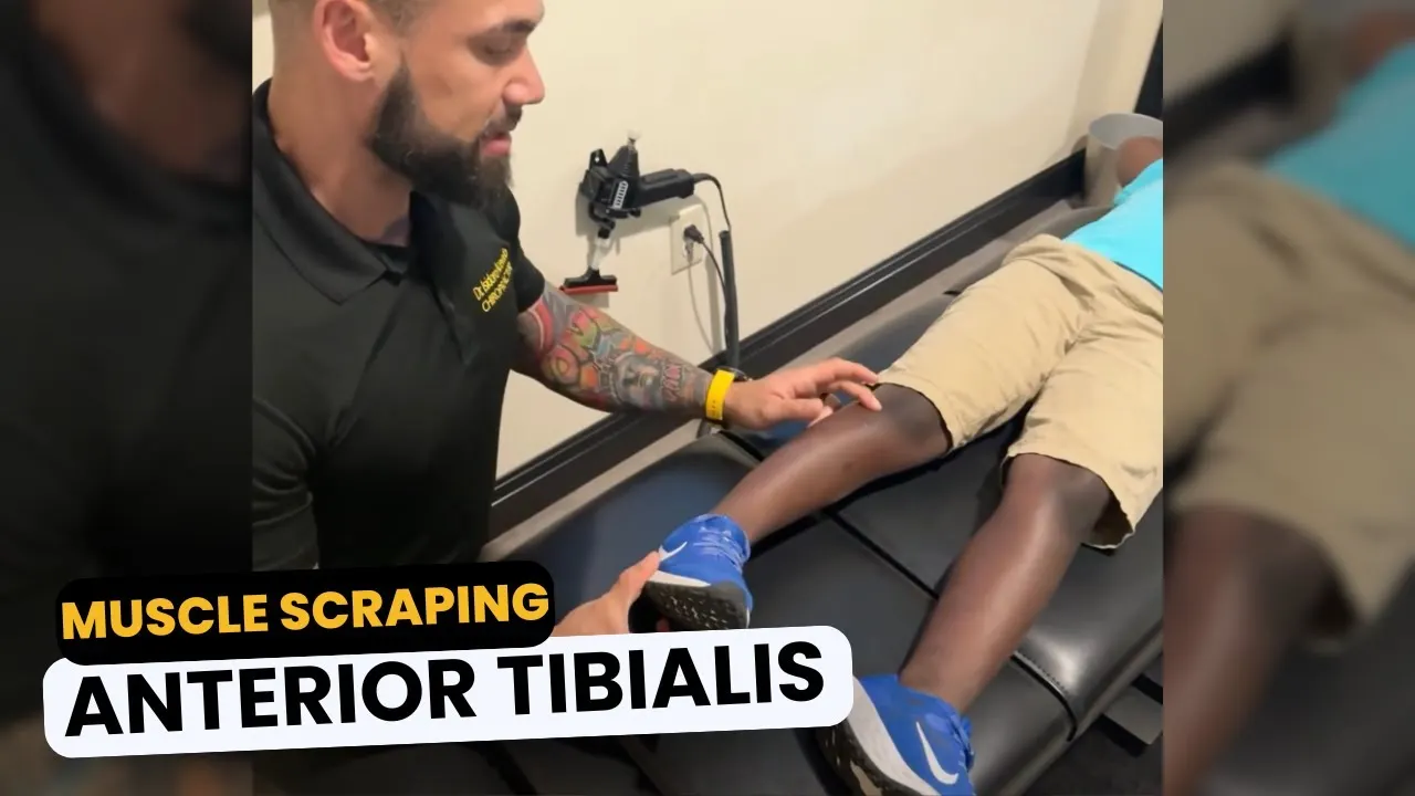 Muscle Scraping for Anterior Tibialis